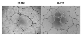 혈관형성능 확인