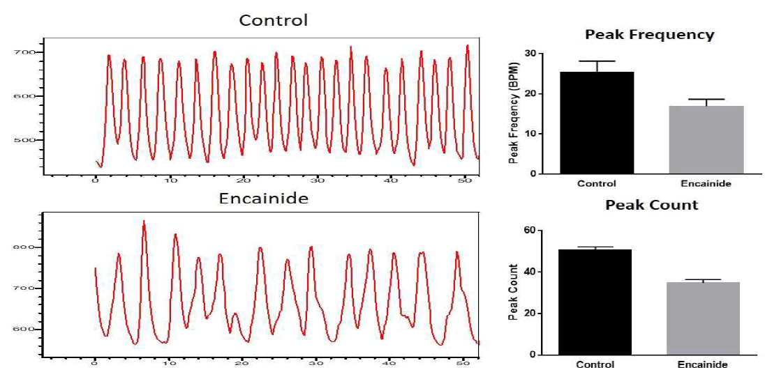 Encainide을 처리 후, 인간 심근세포에서의 calcium 신호 변화 (peak count와 peak pattern) 따른 peak 변화 비교