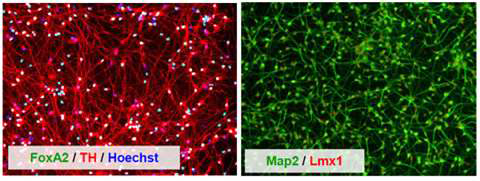 Dopaminergic neurons의 특정 마커 형광 염색