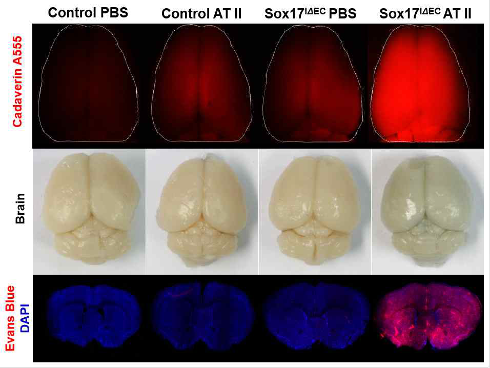 Sox17 내피-결핍 및 Angiotensin II-유도 고혈압 생쥐의 뇌에서 정맥 주입된 Cadaverine A555 염료의 누출을 확인함. 유사하게 정맥 주입된 Evans blue 염료도 뇌 실질로 유출됨