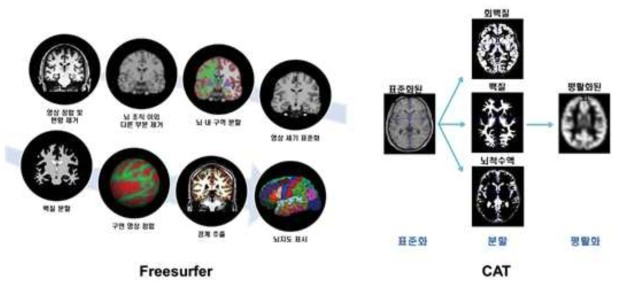 Freesurfer와 CAT을 이용한 분석의 개념도