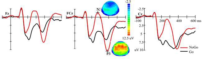 Go/Nogo task 수행 시, 각각 task 사이의 PTSD 환자들의 N200 및 P3a 파형 차이 비교