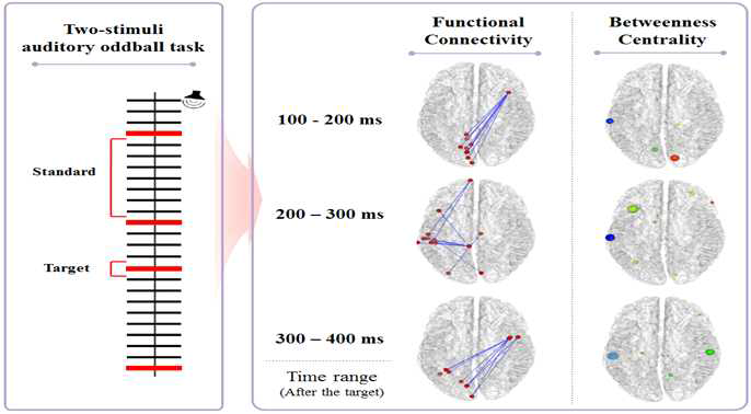 기본 청각 양자극 방안 수행 시, 시간 변화에 따른 기능적 연결성 및 네트워크 변화 양상