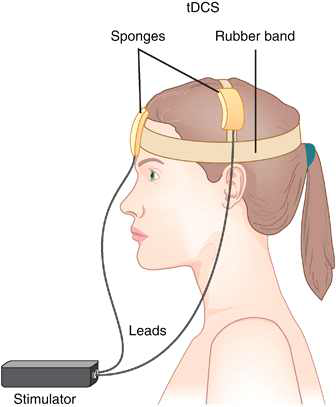 Transcranial direct current stimulation (tDCS)