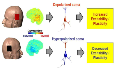 tDCS를 이용한 뇌의 흥분성 및 가소성 조절