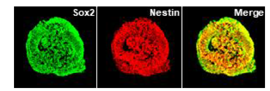 iPSC로부터 분화된 신경줄기세포 neurosphere 에서 신경줄기세포마커인 sox2와 nestin 의 발현