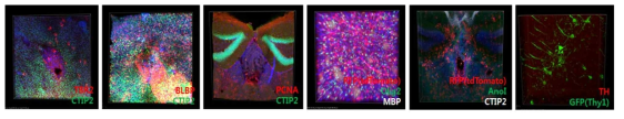 투명화조직의 3차원 이미징을 통한 뇌발달, 구조 관련 단백질 마커 발현 패턴 확인