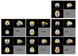 분석에 사용된 독립 성분들 (resting-state networks)