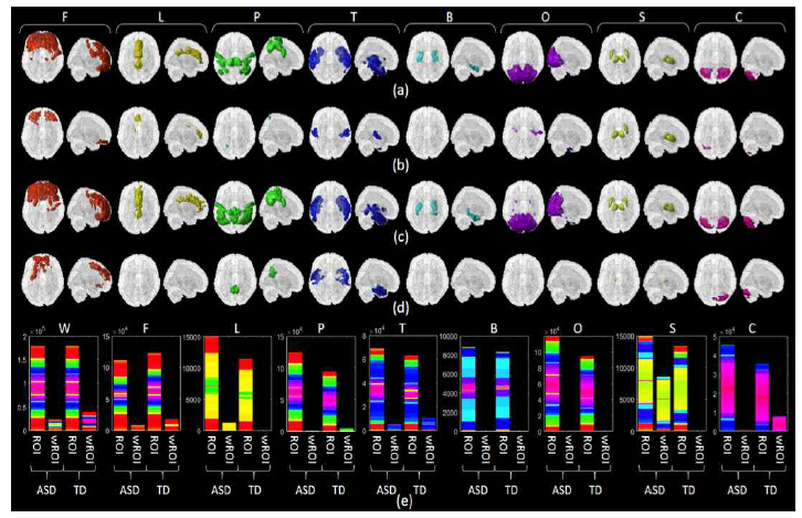 (a) ASD에서 선택된 노드 (ROI), (b) ASD에서 선택되었으면서 ASD에서만 유의미하게 발견된 노드들 (wROI), (c) TD에서 선택된 노드 (ROI), (d) TD에서 선택되었으면서 TD에서만 유의미하게 발견된 노드들 (wROI), (e) 각 lobe에서 선택된 브레인 영역을 보여주는 bar graph, 빨강은 frontal lobe, 노랑은 limbic region, 초록은 parietal lobe, 파랑은 temporal lobe, 하늘색은 basal ganglia, 보라색은 occipital lobe, 연두색은 다홍색은 cerebellum을 뜻한다. 각 노드들, 즉 ROI들은 데이터 기반으로 구했기 때문에 여러 lobe에 연결되어 형성되기도 한다. 이 때 ROI의 lobe는 가장 많이 차지하는 lobe로 배정된다. 이를 통해 인접 lobe간의 연결성을 확인할 수 있다. 예를 들어, amygdala, hippocampus, parahipocampus는 TD에서는 temporal lobe에 있는 영역들과 더 가깝게 붙어 있지만 ASD에서는 subcortical 영역과 더 가깝게 붙어있다