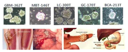 다양한 암종의 환자유래세포 배양 확립