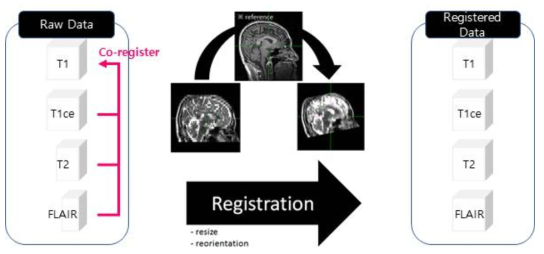 멀티모달 MR 이미지의 co-registration 방법 개요도