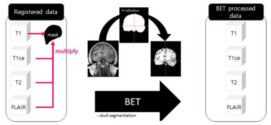 T1, T1ce, T2, FLAIR MR이미지의 BET(brain skull stripping) 방법