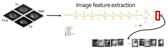 멀티모달 MR 이미지를 사용하여 Inception V3를 통해 뇌종양 이미지 특징을 추출하는 알고리즘 도식