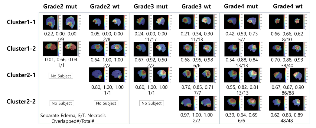 추출한 CAM 이미지의 정량적 분석 결과. cluster별, IDH mutation 및 종양 레벨에 따른 각 항목별 정보의 가시화