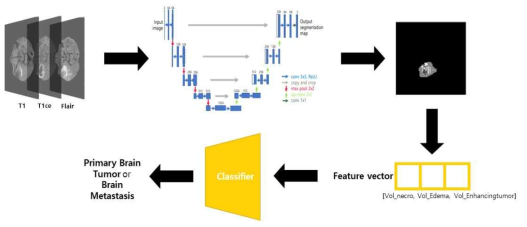 원발성뇌암, 뇌전이암 구분을위한 전처리 및 실험과정 전체 과정