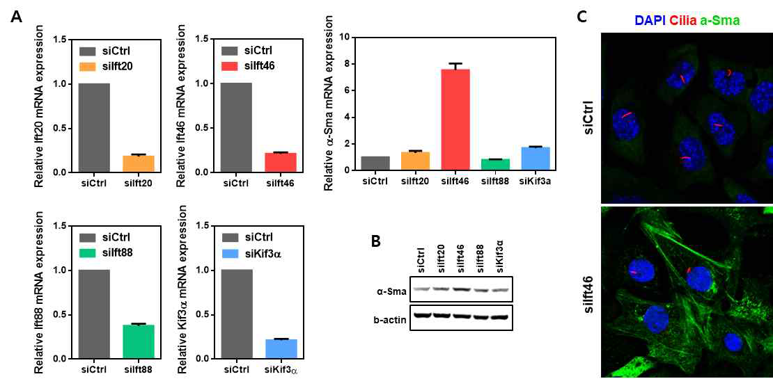 Ift46 발현 감소에 따른 α-Sma mRNA(A), 확인 단백질(B) 발현 증가 확인 및 Ift46 발현 감소에 따른 α-Sma 과발현 세포에서 섬모 표현형 확인