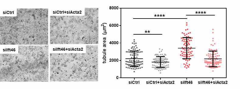 3D tubulogenesis 실험을 통한 α-Sma 발현 감소에 따른 mesenchymal 특성 감소 확인