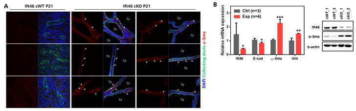 Ift46 cKO 마우스의 다낭신 조직에서 α-Sma 발현 검증