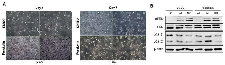 in vitro 낭포 형성에 따른 basal autophagy level 변화 관찰