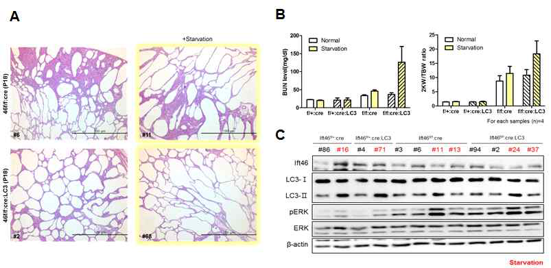 in vivo 상 autophagy 유발 시 신장 표현형 및 신기능 변화 확인