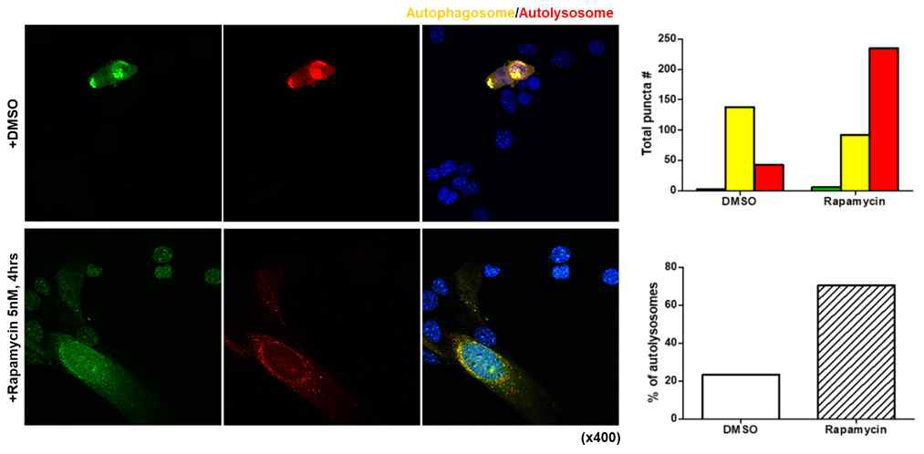 RFP-GFP-LC3로 autophagy