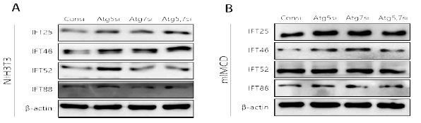 Atg 발현 억제에 의한 Ift 단백질 변화 확인