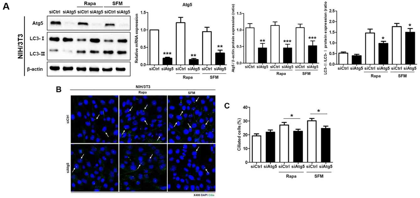 Atg5 발현 저해 시 섬모 형성 변화 관찰