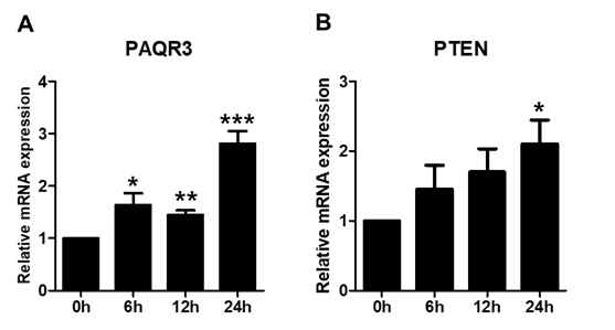 Starvation 시 PAQR3, PTEN 변화