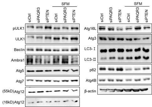 PAQR3와 PTEN 조절에 따른 Atgs 발현 변화 스크리닝