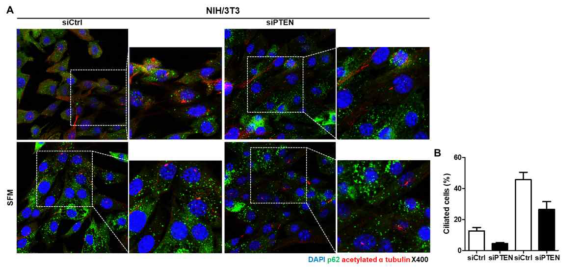 PTEN 변화에 따른 섬모 및 p62 위치 확인