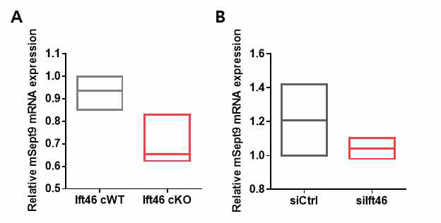 Ift46 cKO 마우스 신장 조직과 Ift46 발현이 감소 된 신장 상피세포에서 Sept9 mRNA 발현 확인