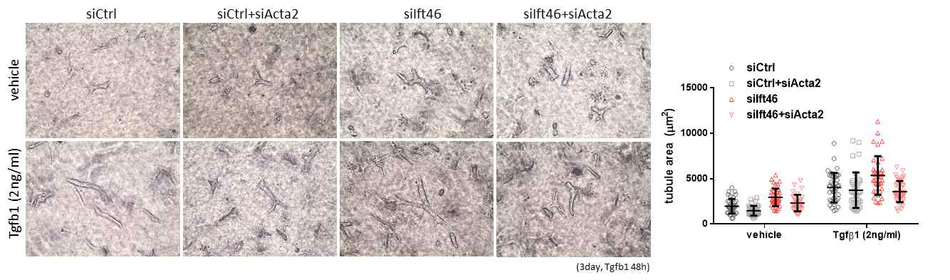 Tgf-b1 처리시, Ift46 발현 감소에 따른 in vitro 3D tubulogenesis 변화 관찰