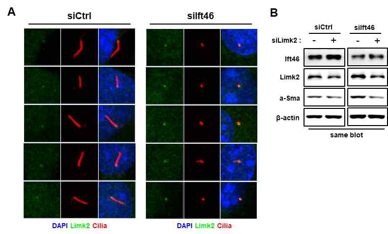 Ift46 발현 감소에 따른 Limk2 단백질 발현 변화 확인