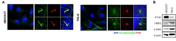 RCC 세포주에서 cilia 관찰 및 주요 단백질 발현 검증 (A) cilia 표현형 및 IFT46 위치 확인 (B) IFT46, LIMK2, α-SMA 단백질 발현 검증