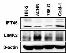 정상 신장 세포와 신장암 세포에서 IFT46, LIMK2 단백질 발현 확인