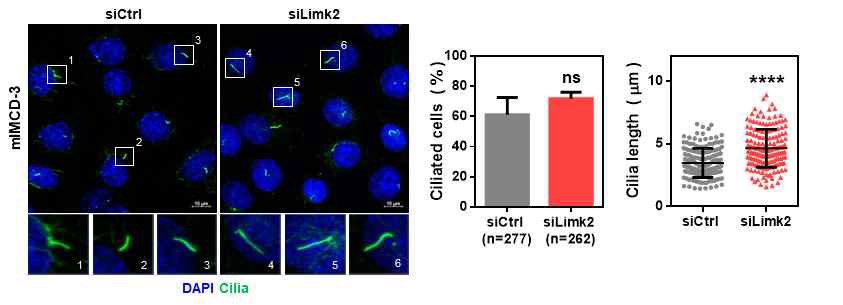 Limk-2 발현 조절에 따른 신장 상피세포의 일차 섬모 형성 변화 확인