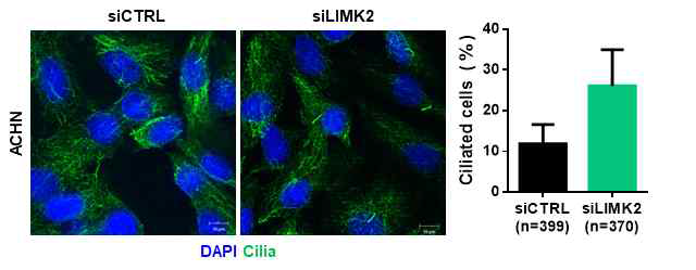 LIMK-2 발현 조절에 따른 신장암 세포주 (ACHN)의 일차 섬모 형성 변화 확인