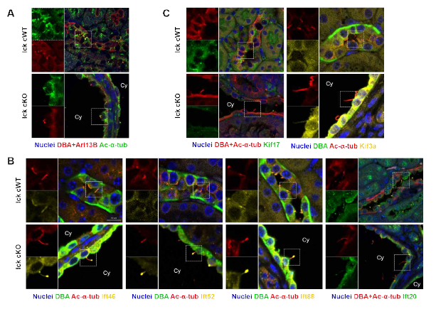 Ick 결함 마우스의 cyst lining cells에서 비이상적인 섬모 관련 단백질의 분포 확인