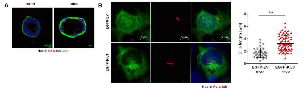 단백질을 억제하였을 때 Klc3 단백질의 발현과 Klc3 단백질을 과발현 시켜주었을 때의 섬모 길이변화 관찰