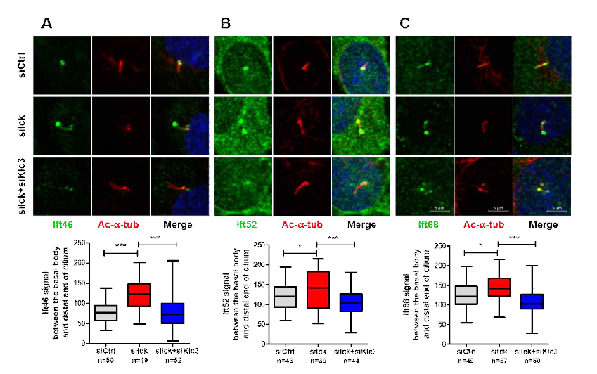 in vitro 상에서 Ick와 Klc3에 의해 IFT46, 52, 88 단백질의 발현, 위치 조절 확인