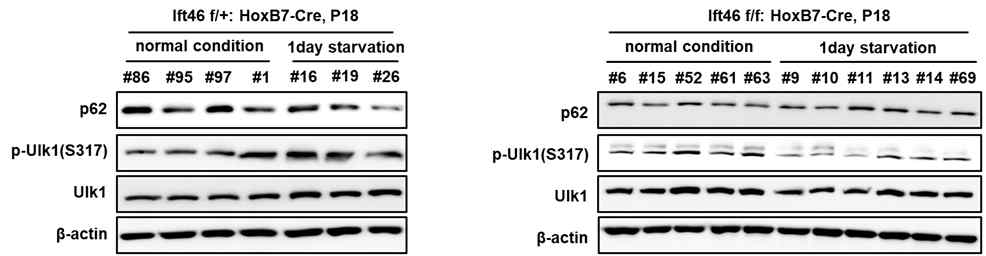 Ift46 결함 모델에서 autophagy 유도 시 반응성 결함 관찰