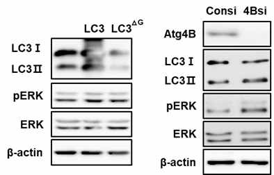 LC3Ⅱ특이 ERK 조절