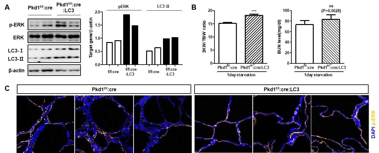 LC3 발현 증가에 따른 Pkd1 결함 동물 표현형 및 ERK 변화 검증