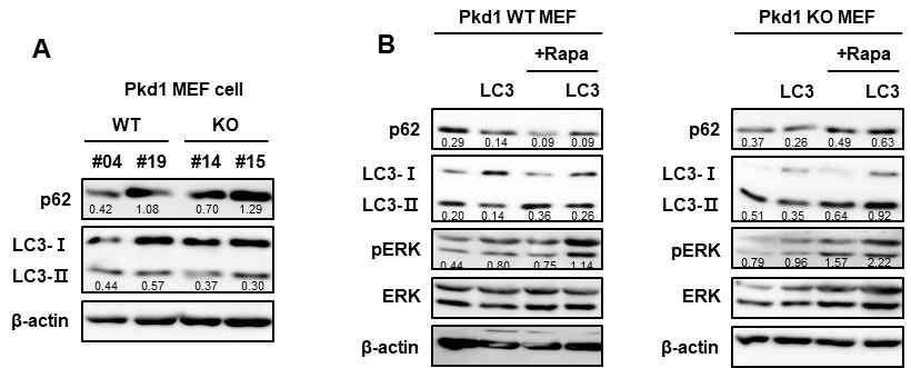 Pkd1 타겟 MEF 세포에서 autophagy flux 변화 관찰