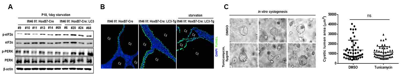 LC3 과발현에 의한 ER stress 및 이로 인한 in vitro 낭포 형성 비교