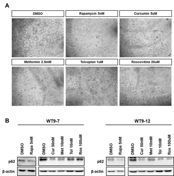 낭포 억제제들에 의한 autophagy flux 조절 확인