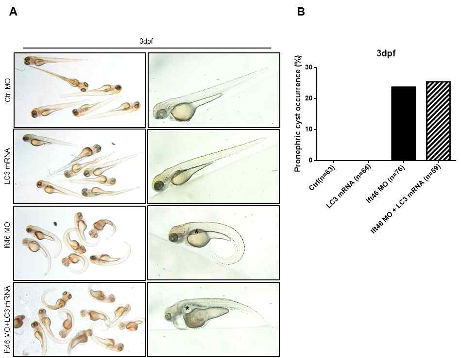 lc3 mRNA 주입에 의한 pronephric duct 낭포 형성 변화 관찰