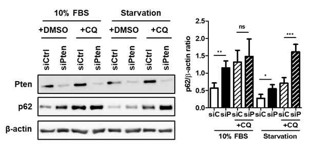 CQ 이용 autophagy flux 변화 관찰