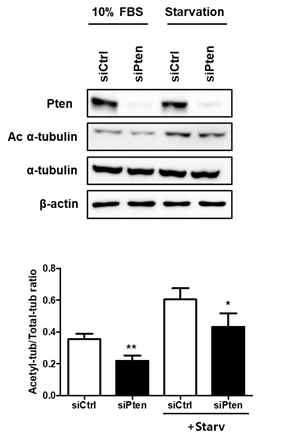 Acetylated α-tubulin 변화 확인