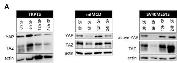 Tubule cell line별 섬모 형성 조절에 따른 YAP/TAZ의 변화